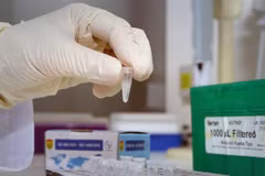 Test xác định virus SARS-CoV-2. (Ảnh: Dương Giang/TTXVN)