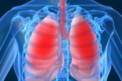 Ảnh minh họa. (Nguồn: Internet)