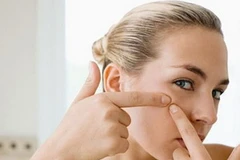 Ảnh minh họa. (Nguồn: Internet)