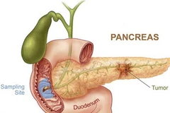 Ảnh minh họa. (Nguồn: trendssoul.blogspot.com)