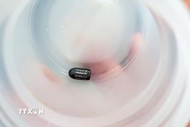 Viên đạn ghim vào đầu chị Th. được các bác sỹ Bệnh viện Đa khoa Trung ương Cần Thơ phẫu thuật lấy ra thành công. (Ảnh: TTXVN phát)