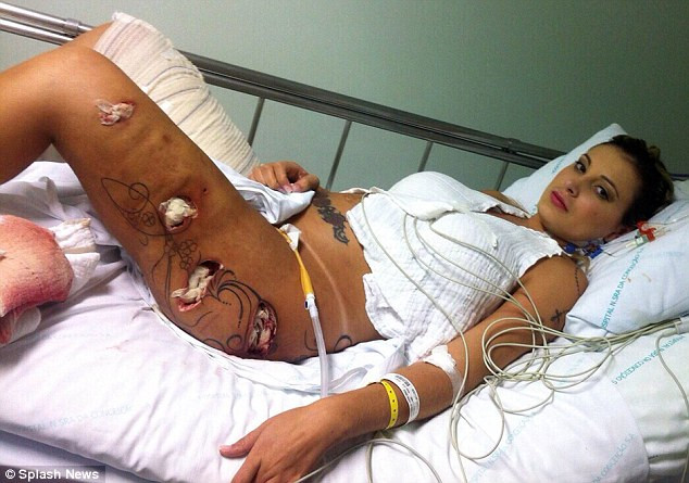 Á hậu suýt mất chân vì phẫu thuật thẩm mỹ lại phải nhập viện ảnh 2