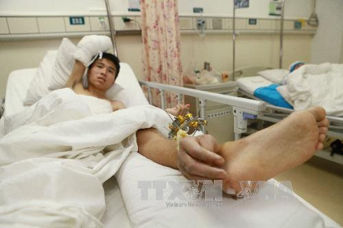 Kỳ lạ chàng trai có bàn tay mọc gần...bàn chân ảnh 1