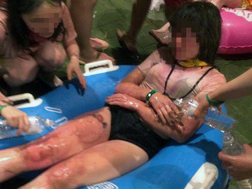 Đài Loan: Cháy công viên nước Formosa, cả trăm người bị bỏng ảnh 1