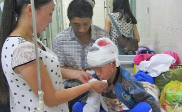 Trung Quốc truy bắt thầy giáo đánh học sinh rạn hộp sọ ảnh 1