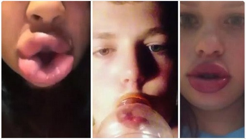 Giới trẻ Mỹ phát cuồng vì đôi môi mọng của cô em nhà Kardashian ảnh 2