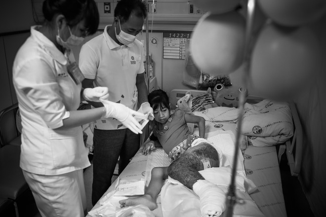 Bài 4: [Photo] Ám ảnh giấc mơ được đi của cô bé chân voi ảnh 6