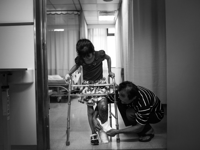 Bài 4: [Photo] Ám ảnh giấc mơ được đi của cô bé chân voi ảnh 12