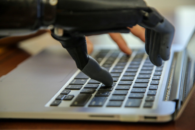 Cánh tay robot Made in Vietnam dành cho người khuyết tật ảnh 9