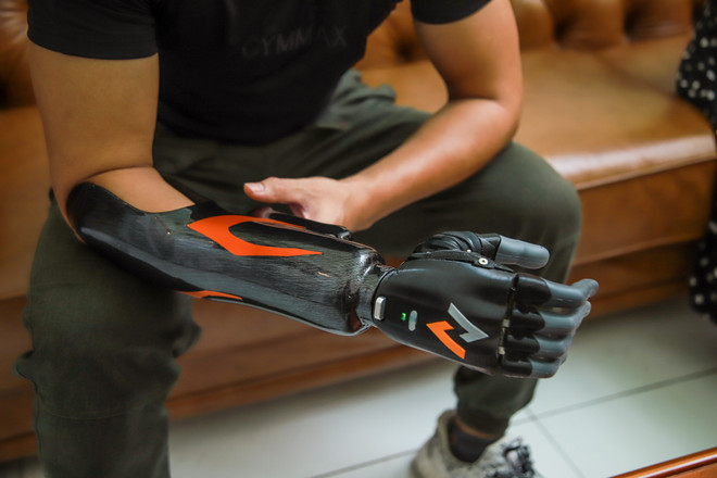 Cánh tay robot Made in Vietnam dành cho người khuyết tật ảnh 2