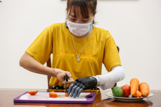 Cánh tay robot Made in Vietnam dành cho người khuyết tật ảnh 13