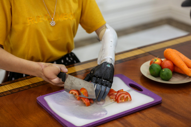 Cánh tay robot Made in Vietnam dành cho người khuyết tật ảnh 14