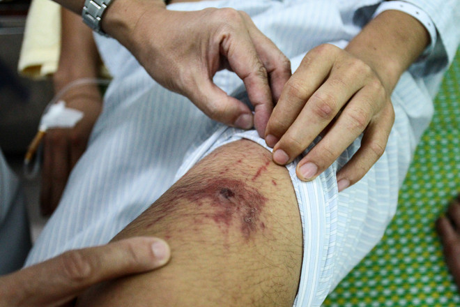 Cận cảnh nơi căng sức khống chế dịch sốt xuất huyết ở Hà Nội ảnh 9