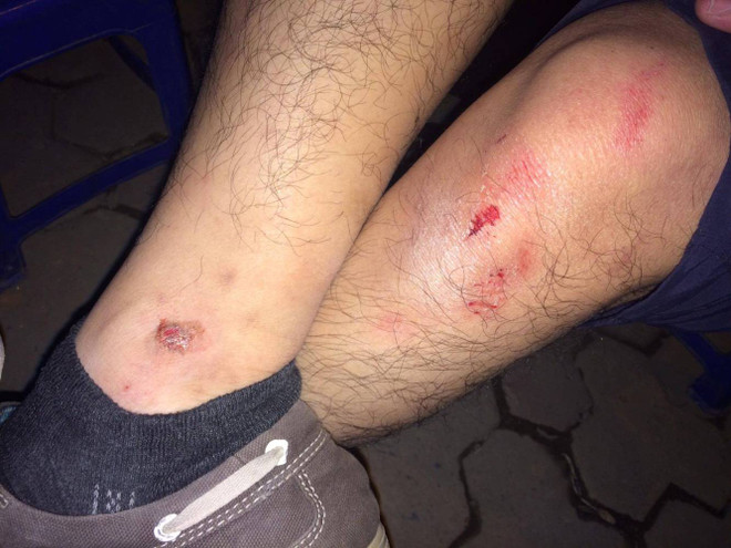 Hà Nội: Dầm thép khổng lồ bất ngờ đổ sập giữa đường ảnh 2