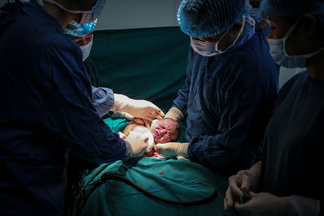 Em bé được các bác sĩ cẩn thận nhấc ra, mọi động tác phải vừa nhanh chóng vừa phải cẩn thận, chính xác. (Ảnh: Minh Sơn/Vietnam+) Lặng người trước hình ảnh vượt cạn đầy cảm xúc của bà mẹ Việt ảnh 6