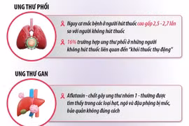 Điểm tên 5 “sát thủ ung thư” nguy hiểm nhất