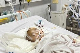 Quảng Ngãi: Bé trai xuất huyết não bất thường tại điểm giữ trẻ tự phát
