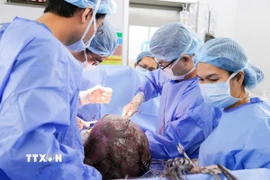 Các bác sỹ Bệnh viện Từ Dũ Thành phố Hồ Chí Minh tiến hành phẫu thuật bóc tách khối u xơ tử cung khổng lồ cho bệnh nhân. (Ảnh: TTXVN phát)