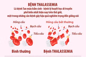 Ngày Thalassemia Thế giới 8/5: Những điều cần biết về bệnh Thalassemia