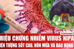 Chuyên gia: Cách nhận biết sớm dấu hiệu của người nhiễm virus Nipah