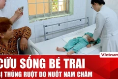 Bệnh viện Nhi đồng Đồng Nai cứu thành công ca thủng ruột do nuốt nam châm