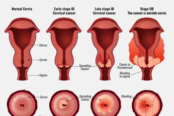 (Ảnh minh họa. Nguồn: singingriverhealthsystem)