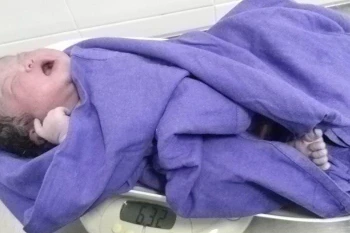 Quảng Ninh: Mổ thành công cho một sản phụ sinh em có cân nặng "khủng"