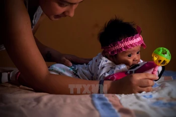 Một em bé bị mắc chứng đầu nhỏ tại thủ đô Quito, Ecuador, ngày 27/2. (Nguồn: THX/TTXVN)