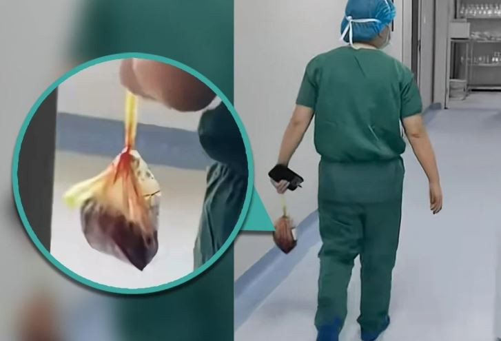 Một bác sỹ sản khoa không rõ danh tính đã bị quay lại cảnh lấy nhau thai từ phòng phẫu thuật trong một túi nylon, đi đến văn phòng của mình và giấu nó trong một túi đựng rác màu đen. (Nguồn: Douyin/SCMP)