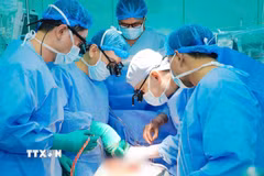 Các bác sỹ thực hiện ghép tim cho người bệnh. (Ảnh: TTXVN phát)