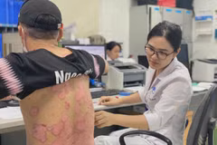 Bác sỹ khám cho một bệnh nhân mắc vảy nến. (Ảnh: PV/Vietnam+)