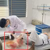 Bệnh nhân nhập viện trong tình trạng cẳng chân hoại tử nặng, bốc mùi hôi thối. (Ảnh: PV/Vietnam+)