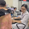 Bác sỹ khám cho một bệnh nhân mắc vảy nến. (Ảnh: PV/Vietnam+)