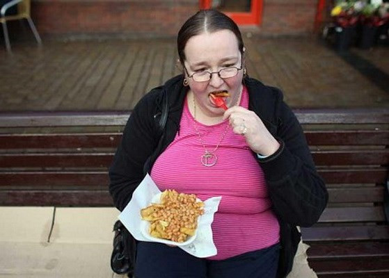 Phẫu thuật giảm cân giúp người béo phì cải thiện khả năng vận động ảnh 1