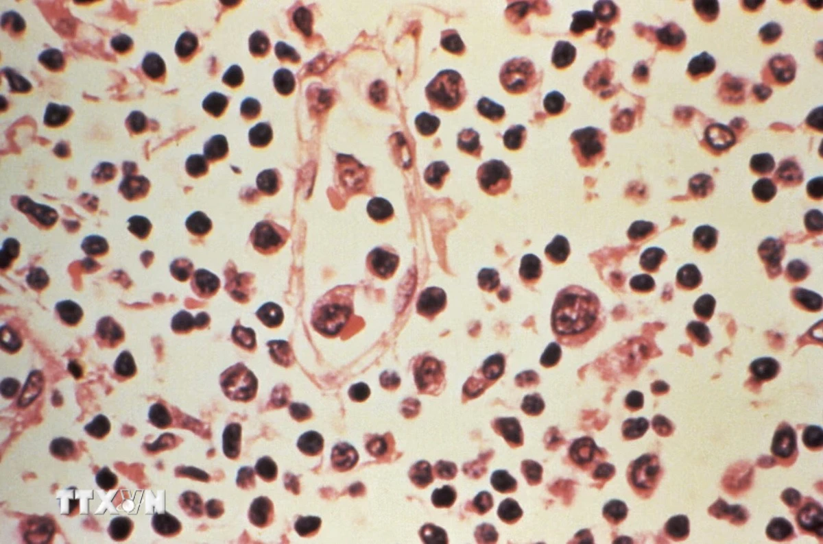 Việt Nam tăng cường kiểm dịch biên giới phòng virus Hanta