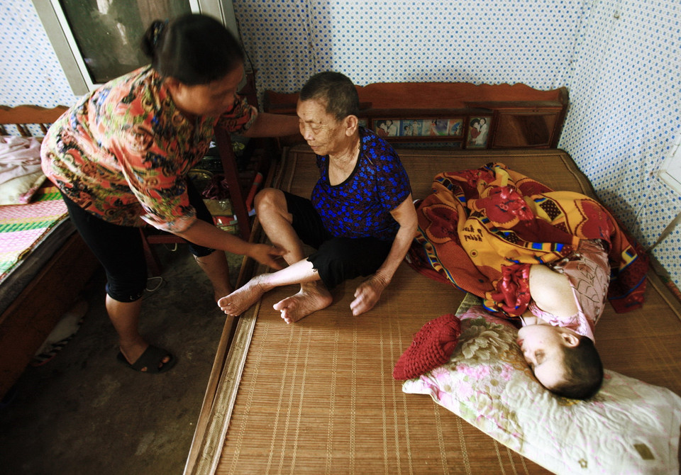 Hàng chục năm qua chị Đinh Thị Lương (trái, sinh 1965) ở thôn Đoàn Kết, xã Quang Bình, huyện Kiên Xương không có giấc ngủ nào quá 2 tiếng đồng hồ vì phải chăm sóc cả mẹ già và em gái Đinh Thị Nguyên (phải, sinh 1976). Chị Nguyên chịu ảnh hưởng chất độc da cam/dioxin từ bố là ông Đinh Văn Thoan (sinh 1924, mất cuối năm 2010), bị tâm thần, ngày nào cũng lên cơn động kinh và sống hoàn toàn nhờ sự giúp đỡ của chị gái. (Ảnh: Lâm Khánh/TTXVN)