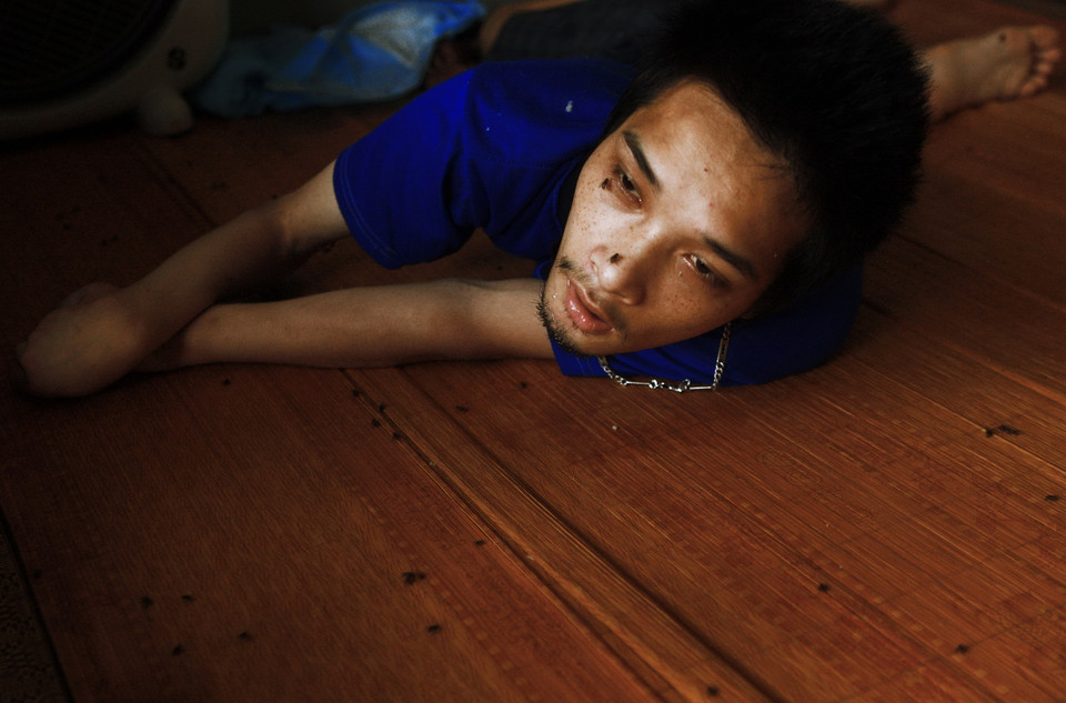 Anh Nguyễn Văn Quân (sinh 1991) mắc chứng bại liệt toàn thân từ khi sinh ra tại thôn Nam Tiến, xã Quang Hưng, huyện Kiến Xương. Ông Nguyễn Văn Toán (bố anh Quân, sinh 1955) có 3 người con đều là nạn nhân chất độc da cam/dioxin. (Ảnh: Lâm Khánh/TTXVN)