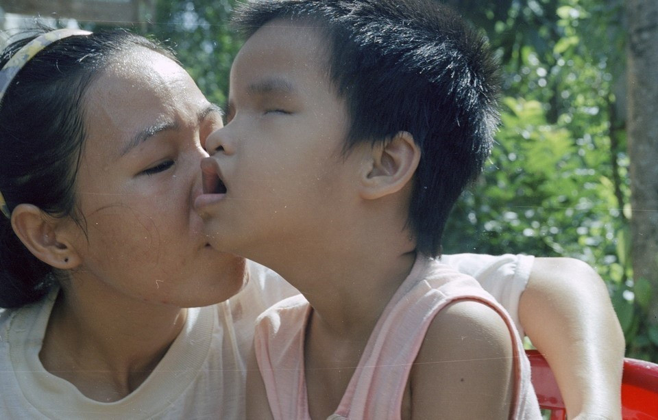 Chị Trương Thị Thi (thôn Nghĩa Phong, xã Cam Nghĩa, huyện Cam Lộ, tỉnh Quảng Trị) bị di chứng chất độc da cam/dioxin (2002). (Ảnh: Ngô Mỹ/TTXVN)