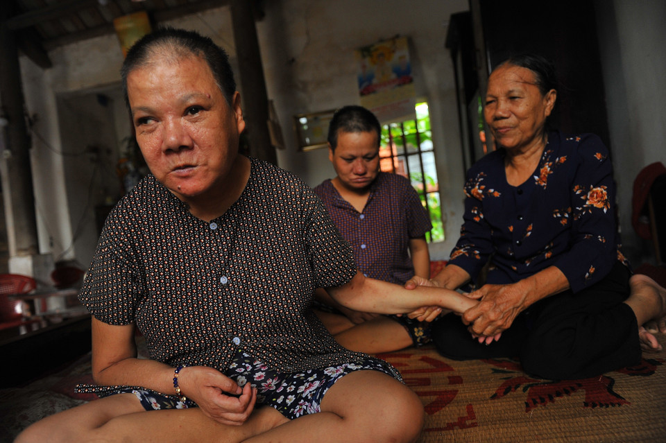 Bà Vũ Thị Dơn, xóm Chùa, xã Khánh Nhạc, huyện Yên Khánh, tỉnh NInh Bình, có 2 con gái đều bị bệnh tâm thần do ảnh hưởng chất độc da cam/dioxin. (Ảnh: Minh Đức/TTXVN)