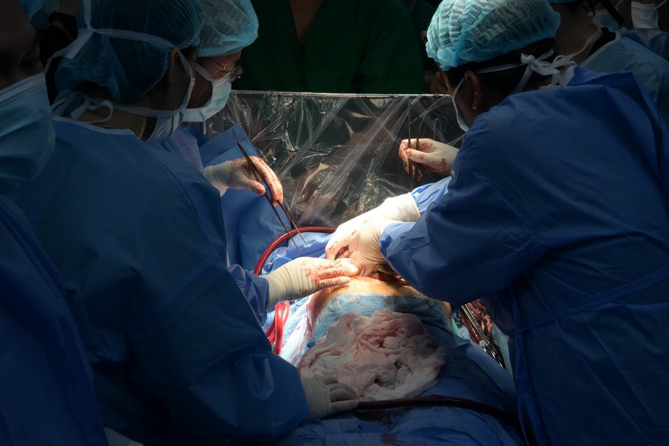 Tiến sỹ-Bác sỹ Cao cấp Đinh Văn Lượng, Giám đốc bệnh viện Phổi Trung ương cùng các thầy thuốc và chuyên gia phối hợp với Giáo sư-Tiến sỹ Lê Ngọc Thành cùng các thầy thuốc và chuyên gia từ Bệnh viện E thực hiện thành công ca ghép phổi. (Ảnh: TTXVN phát)
