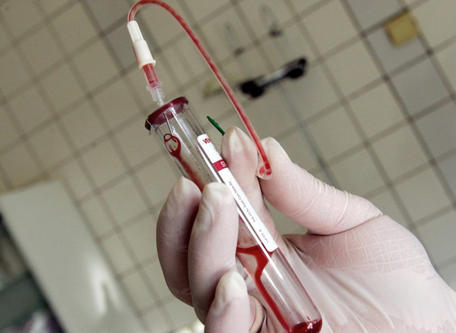 Singapore: Hơn 14.000 người nhiễm virus HIV bị rò rỉ dữ liệu ảnh 1