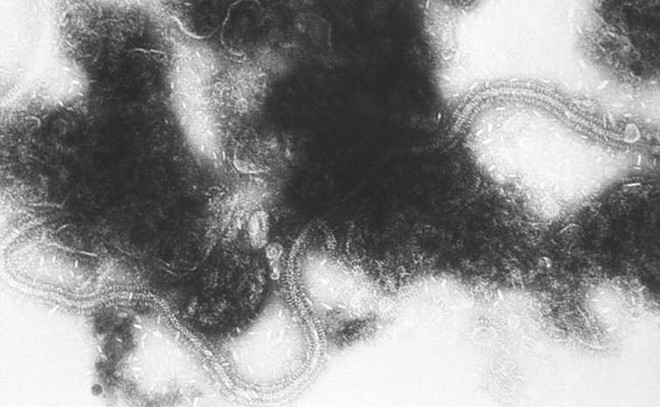 Nhà khoa học Chile tìm ra vắcxin chống virus gây viêm phổi cấp ảnh 1