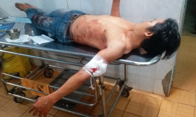 Bức xúc vì tiếng nhạc ồn, một đối tượng cầm dao rựa chém hàng xóm ảnh 1