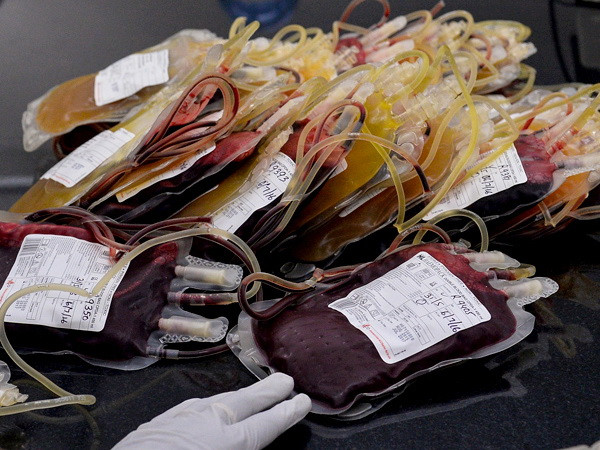 Sốc: Hơn 2.000 người nhiễm HIV sau khi truyền máu ở bệnh viên ảnh 1