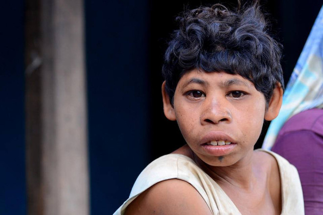 "Cuộc sống Tarzan" của hai anh em ruột người Ấn Độ ảnh 2