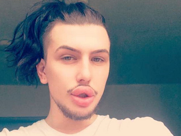 Nam thanh niên phẫu thuật để giống chị em nhà Kardashian ảnh 1