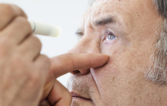 Có thể phát hiện triệu chứng bệnh Alzheimer qua khám mắt ảnh 1