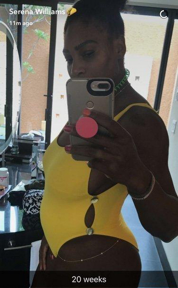 Serena vô địch Australian Open 2017 khi đang mang thai 8 tuần ảnh 2