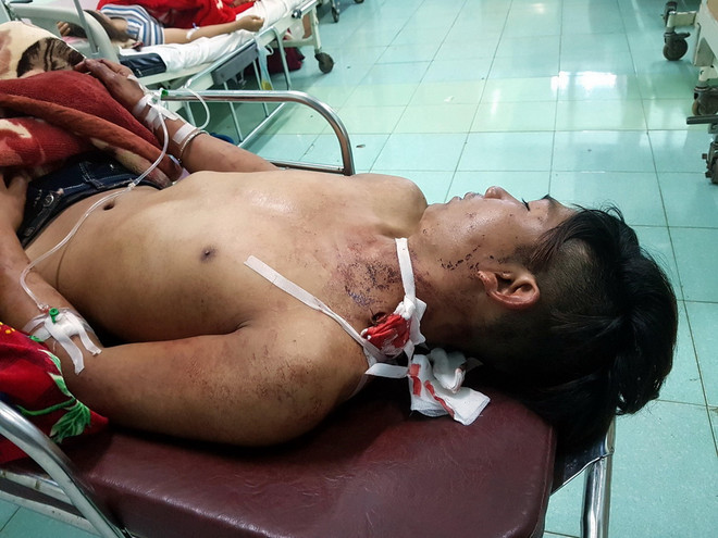 Cứu sống một bệnh nhân bị dao đâm xuyên từ cổ xuống phổi ảnh 1