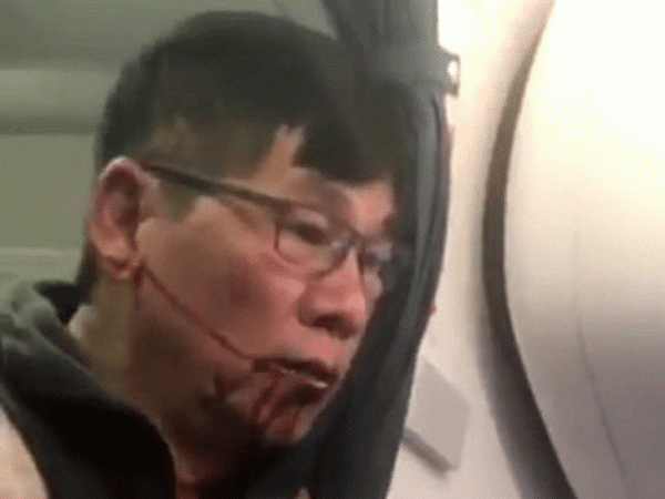 [Video] Bác sỹ gốc Việt bị lôi khỏi máy bay của United Airlines ảnh 1